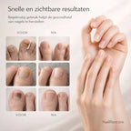 NailRestore – Herstel je nagels zichtbaar van binnenuit